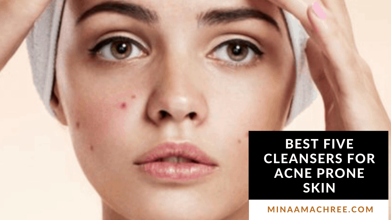 The Best Five Cleansers For Acne Prone Skin