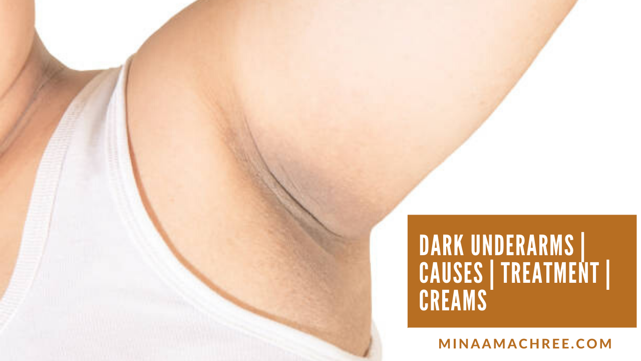 Dark Underarms, Causes, Treatment, Creams